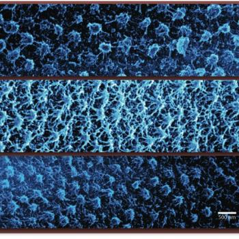 Attacking Cancer Cells with Hydrogel Nanoparticles